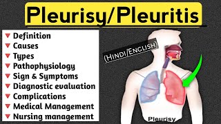 PleurisyPleuritis lecture in Hindi and English medical nursingcriteria pleuritis paramedical [upl. by Rehoptsirhc]