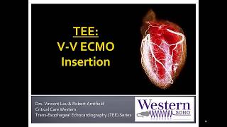 Transesophageal Echocardiography VenoVenous ECMO Initiation [upl. by Leaw755]