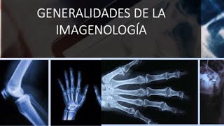 Generalidades de la Imagenología Rx US TAC y RM [upl. by Engis731]