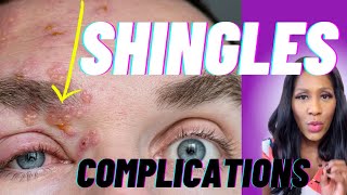 DANGEROUS Shingles Complications Postherpetic Neuralgia Ramsay Hunt Syndrome amp Zoster Opthalmicus [upl. by Eblehs]