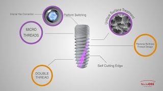 NucleOSS T6 Implant [upl. by Bellaude493]