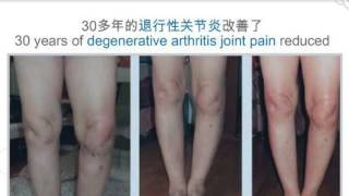 Ageloc R2 Before amp After Testimonial [upl. by Ecirtram]