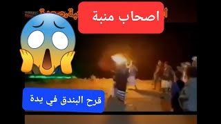 قرح ابندق في يدة 😱😱😱😱 [upl. by Adnohr]