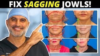 Sagging Jowls 101 How they form and what to do about them tighten and eliminate [upl. by Atiekal532]