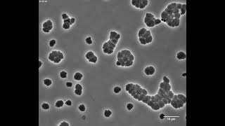 Cholera bacteria can survive antibiotics for a time by turning into globs [upl. by Notwen]