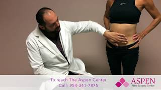 Liposuction Contour Irregularity  Stubborn Lipo Lumps and Bumps [upl. by Deehan]