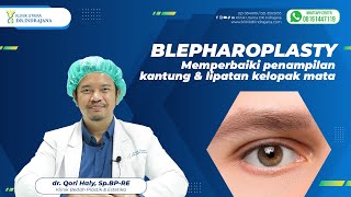 BLEPHAROPLASTY  MEMPERBAIKI PENAMPILAN KANTUNG DAN LIPATAN KELOPAK MATA [upl. by Naawaj]