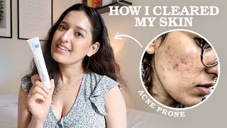 My 3 Step EvidenceBased Skincare Routine As A Doctor  HOW I CLEARED MY ACNE  Affordable Easy [upl. by Bekaj]