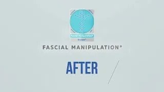 BEFORE amp AFTER FASCIAL MANIPULATION 2 [upl. by Lanta6]