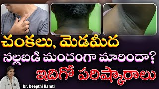 చర్మం నల్లగా మారిందా  Symptoms and Causes of Acanthosis Nigricans in Telugu  Dr Deepthi Kareti [upl. by Conley]