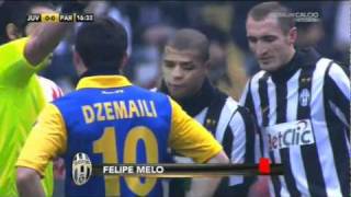 Claudio Zuliani  ESPULSIONE DI FELIPE MELO in JuventusParma 14 612010 QUESTO NON LO DEVI [upl. by Rina604]