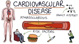 Understanding Cardiovascular Disease Visual Explanation for Students [upl. by Madelina]