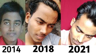 Big Forehead को Receding Hairline समझना Band Karo 😡 🤒 Teenage Receding Hairline Confusion Solved [upl. by Russel]