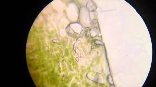 Plant Cells In Hypertonic Solution of KNO3 Potassium Nitrate  Under Microscope [upl. by Ylac263]