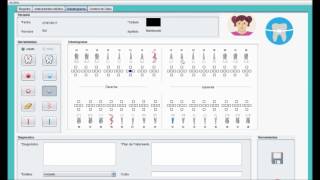 Odontograma en JAVA [upl. by Einahpad]