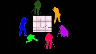 CURSO DE ELECTROCARDIOGRAFIA 05  LA RAZÓN DE SER DE LAS DERIVACIONES ELECTROCARDIOGRÁFICAS [upl. by Nahtan]