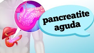 PANCREATITE AGUDA QUANDO SUSPEITAR DOS SINTOMAS [upl. by Gagnon]