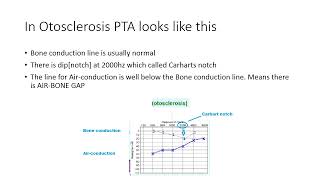 Otosclerosis 4th year [upl. by Ardnaz]