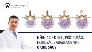 Hérnia de disco protusão extrusão e abaulamento discal O que são [upl. by Kirbee640]