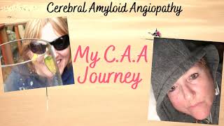 Do I have the signs of Vascular Dementia My CAA Journey Cerebral Amyloid Angiopathy [upl. by Griffis195]