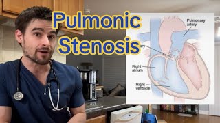 Pulmonic Stenosis in Pets [upl. by Akinoj]