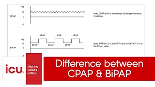 Difference between CPAP and BiPAP  NIV vs CPAP [upl. by Halian878]