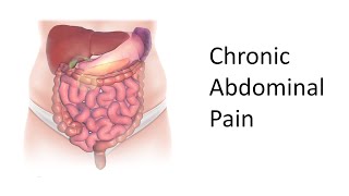 An Approach to Chronic Abdominal Pain [upl. by Nitsraek559]