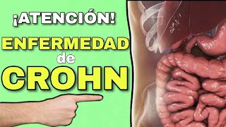 ENFERMEDAD de CROHN🤯 ¿QUÉ ES ¿CAUSAS ¿FISIOPATOLOGÍA 📌 [upl. by Theta]