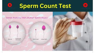 Sperm Count Test  Semen Analysis [upl. by Ihsakat]