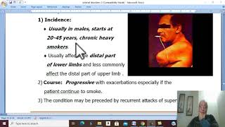 Arterial Disorders in Arabic 27  Buergers Disease  part 1   by Dr Wahdan [upl. by Lillith]