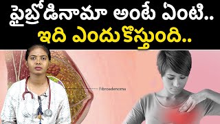 What is Fibroadenoma know here all details  ఫైబ్రోడినామా అంటే ఏంటి ఇది ఎందుకొస్తుంది [upl. by Strickland354]