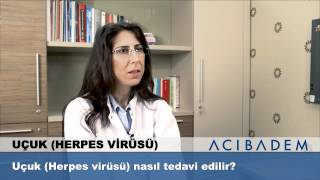 Uçuk Herpes Virüsü nasıl tedavi edilir [upl. by Sidonius]