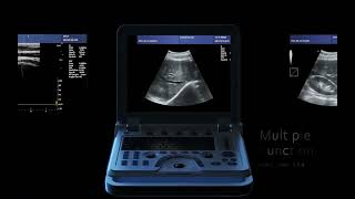 CONTEC ultrasound Scanner Doppler CMS600P2 PLUS [upl. by Cirdes]