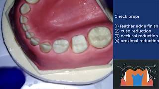 Conventional crown preparation for PMC  Institute of Dentistry QMUL [upl. by Anicul]