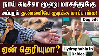 நாய் கடிச்சா நாய் மாதிரி குரைப்பாங்களா  Everything you should know about Rabies  Rabies symptoms [upl. by Euqinu]