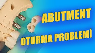 İmplant Üstü Abutment Oturma Problemi [upl. by Blunk]