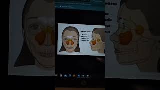 Paranasal Sinuses song music arijitsingh anuvjain grossanatomy humananatomy anatomyhumanbody [upl. by Nesyla]