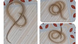 Ascaris lumbricoides 🥨 Round Worm 🪱  AschelminthesNematodes [upl. by Ednihek229]