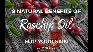 9 Natural Benefits of Rosehip Oil for Your Skin [upl. by Noak567]