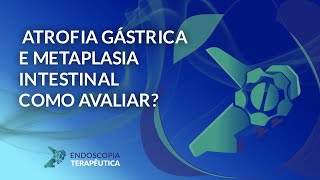 Atrofia gástrica e metaplasia intestinal como avaliar [upl. by Leanna]