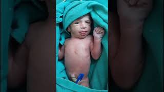 Newborn care  baby born at 32 weeks  youtubeshortsviralvideoviralshortsnewbornpediatricians [upl. by Ayal]