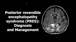 Posterior reversible encephalopathy syndrome [upl. by Judah855]