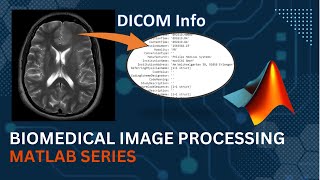 Getting Info of DICOM file  MATLAB  Medical Image Processing [upl. by Ahcire]