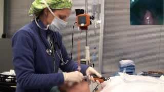 Video laryngoscope Tracheal intubation with Bougie Port [upl. by Ddart256]