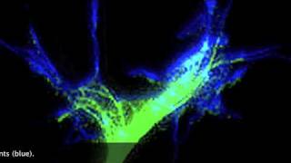 Nerve growth conessubtitles only [upl. by Siloum]