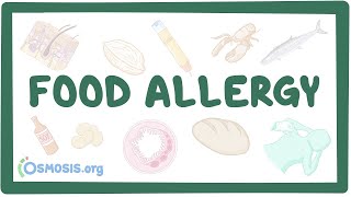 Food allergy  an Osmosis Preview [upl. by Siseneg414]