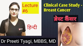 CLINICAL CASE STUDY OF BREAST ANATOMY [upl. by Aitnic192]