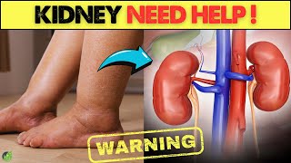 7 Skin Warning Signs That Your Kidneys May Be In DANGER  Health Journey [upl. by Rivera]