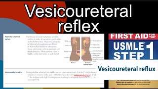 Vesicoureteral reflex in HindiUrdu by first aid for USMLE step 1 [upl. by Hamforrd]