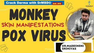 Monkey Pox virus  MPOX  Dermatological  SKIN Manifestations DrMSD Dr Maddineni Srinivas  WHO [upl. by Ause]